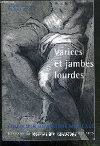 Varices et jambes lourdes